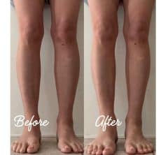 STORYライターが2週間で【美脚】を目指す！おうちでマッサージとむくみ取りスリッパでどこまで変わった？