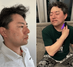 40代の夫に「1カ月電気ブラシ」をさせてみたらすごかった！リアルな結果は…