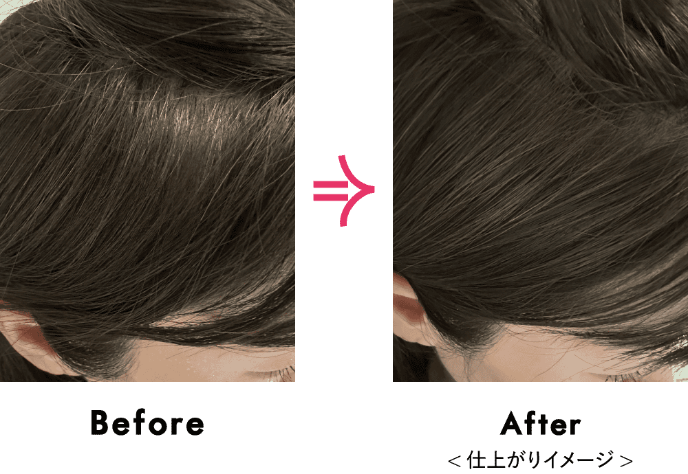 Before After