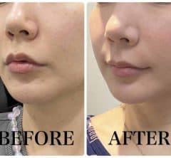 40代渡韓マニア行きつけ！「韓国美容クリニック5選」。やってよかった最新美容医療は？