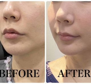 40代渡韓マニア行きつけ！「韓国美容クリニック5選」。やってよかった最新美容医療は？