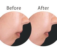 早く始めた方がトク!? 【大人の歯列矯正】を詳しく知りたい