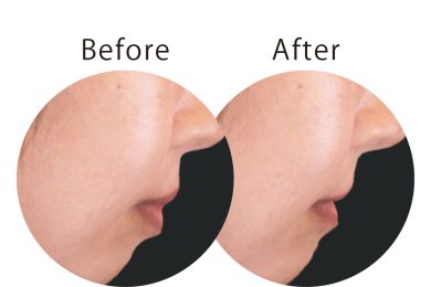 早く始めた方がトク!? 【大人の歯列矯正】を詳しく知りたい