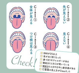 おたくは大丈夫？【いびき離婚】今すぐセルフ診断→対策グッズ＆治療法をチェック！