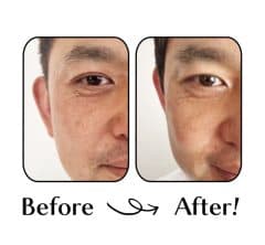 40代の夫に「1ヵ月アイクリーム」をさせてみたら、すごい結果が!!