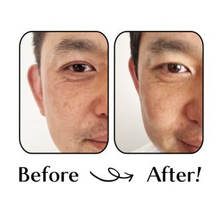 40代の夫に「1ヵ月アイクリーム」をさせてみたら、すごい結果が!!