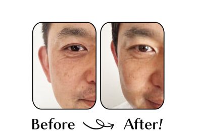 40代の夫に「1ヵ月アイクリーム」をさせてみたら、すごい結果が!!